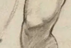 représentation du genou de Sargent